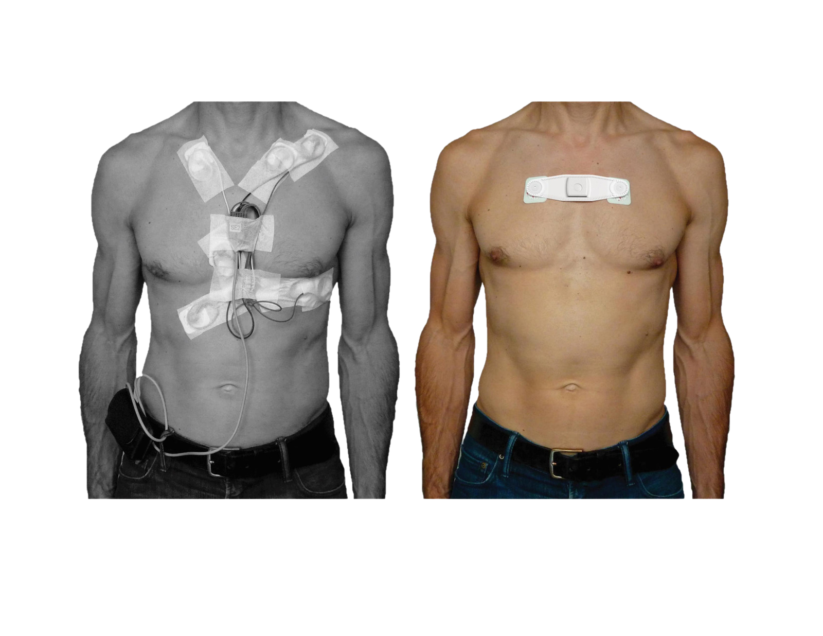 Le Monitorage Cardiaque Repens Avec CardioSTAT S Ouellet Et C A le-monitorage-cardiaque-repens-avec-cardiostat-s-ouellet-et-c-a